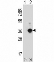 Western blot analysis of ANGPTL7 antibody and 293 cell lysate either nontransfected (Lane 1) or transiently transfected (2) with the ANGPTL7 gene.