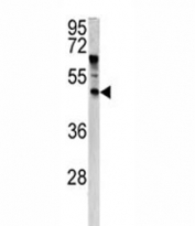 Western blot analysis of ANGPTL7 antibody and HeLa lysate. Predicted molecular weight ~35 kDa, observed at 35-50 kDa depending on glycosylation level.