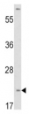 Western blot analysis of VHL antibody and HepG2 lysate.