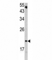 Western blot analysis of VHL antibody and HepG2 lysate.