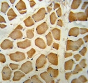 NPEPPS antibody IHC analysis in formalin fixed and paraffin embedded human skeletal muscle.