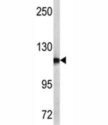 Western blot analysis of NPEPPS antibody and MCF-7 lysate.~
