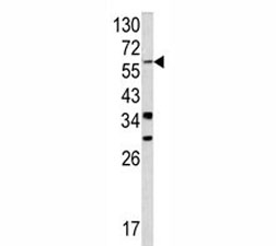 Western blot analysis of YAP antibody and NCI-H460 lysate.~