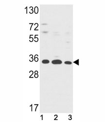 Western blot analysis of Annexin V antibody and (1) HepG2, (2) A2058, (3) T47D lysate. Predicted molecular weight ~36 kDa.