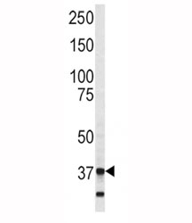 Western blot analysis of Annexin V antibody and SK-BR-3 lysate. Predicted molecular weight ~36 kDa.