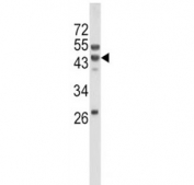 Western blot analysis of WNT10B antibody and mouse liver tissue lysate. Predicted molecular weight ~45 kDa.