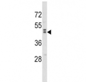 Western blot analysis of WNT10B antibody and human MDA-MB231 lysate. Predicted molecular weight ~45 kDa.