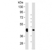 Western blot testing of 1) rat skeletal muscle and 2) human skeletal muscle lysate with WNT10B antibody. Predicted molecular weight ~45 kDa.