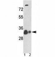 Western blot analysis of VDAC antibody and 1) human A375 cell line and 2) mouse heart tissue lysate. Predicted molecular weight 30~35 kDa.