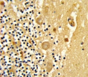 IHC analysis of FFPE human cerebellum stained with GARP antibody
