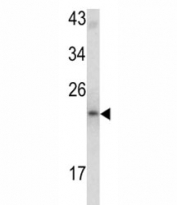 Western blot analysis of MCT-1 antibody and mouse bladder tissue lysate