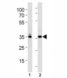 TBP antibody western blot analysis in (1) K562 and (2) U251 lysate. Observed molecular weight: 35-43 kDa.