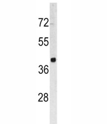 Western blot analysis of TROP2 antibody and HL-60 lysate. Predicted molecular weight ~40 kDa.~