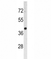 Western blot analysis of TROP2 antibody and HL-60 lysate. Predicted molecular weight ~36 kDa.