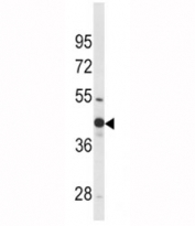 Western blot analysis of WNT4 antibody and mouse bladder tissue lysate.