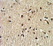 IHC analysis of FFPE human brain tissue stained with PAX4 antibody