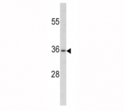 Western blot analysis of PAX4 antibody and human CEM lysate. Predicted molecular weight ~38 kDa.