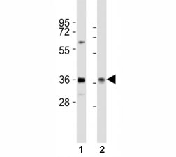 Western blot testing of PAX4 antibody at 1:2000 dilution. Lane 1: HeLa lysate; 2: rat liver lysate; Predicted band size : 38 kDa.