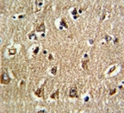 IHC analysis of FFPE human brain tissue stained with RAN antibody