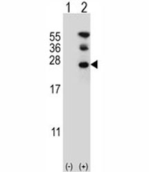 Western blot analysis of RAN antibody and 293 cell lysate either nontransfected (Lane 1) or transiently transfected (2) with the RAN gene.