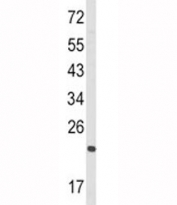 Western blot analysis of RAN antibody and HL-60 lysate.