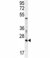 RAN antibody western blot analysis in mouse NIH3T3 lysate.