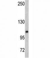 Western blot analysis of OGT antibody and mouse bladder tissue lysate. Expected/observed molecular weight: 110-117 kDa.