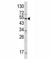 Western blot analysis of ANGPTL3 antibody and human CEM lysate. Expected molecular weight 50 ~ 63 kDa depending on glycosylation level.
