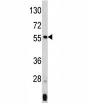 Western blot analysis of ANGPTL3 antibody and mouse liver tissue lysate. Expected molecular weight 50 ~ 63 kDa depending on glycosylation level.