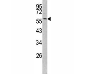 Western blot analysis of Keratin-14 antibody and mouse NIH3T3 lysate