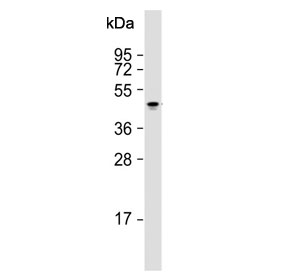 Western blot analysis of Keratin-14 antibody and human A431 cell lysate.