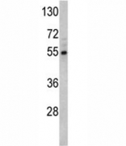 Western blot analysis of Fascin antibody and Y79 lysate. Predicted molecular weight: 55 kDa.