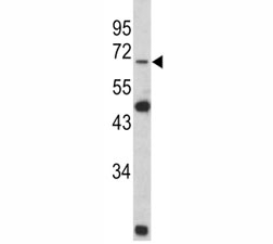 Western blot analysis of Lamin B2 antibody and Y79 lysate