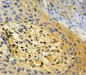IHC analysis of FFPE human skin tissue stained with SPARC antibody