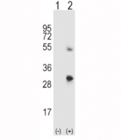 Western blot analysis of SPARC antibody and 293 cell lysate either nontransfected (Lane 1) or transiently transfected (2) with the SPARC gene.