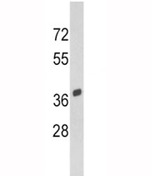 Western blot analysis of SPARC antibody and Y79 lysate. Predicted molecular weight 35-45 kDa depending on glycosylation level