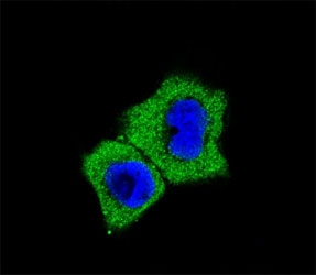 Fluorescent confocal image of A431 cells stained with SMAD7 antibody at 1:25. Immunoreactivity is localized to the cytoplasm.