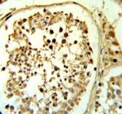 Fascin-3 antibody IHC analysis in formalin fixed and paraffin embedded human testis tissue.