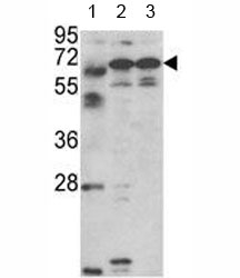 Western blot analysis of Fascin-3 antibody and 1) MDA-MB231, 2) NCI-H460 cell line and 3) mouse testis tissue lysate.