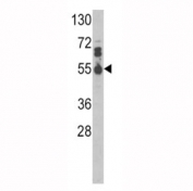 Western blot analysis of IL17RB antibody and MDA-MB468 lysate.