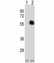 Western blot analysis of GATA2 antibody and 293 cell lysate either nontransfected (Lane 1) or transiently transfected (2) with the GATA2 gene. Predicted molecular weight ~51 kDa.