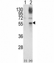 Western blot analysis of GATA2 antibody and 293 cell lysate either nontransfected (Lane 1) or transiently transfected with the GATA2 gene (2). Predicted molecular weight ~51 kDa.