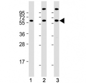 Western blot testing of human 1) K562, 2) 293 and 3) Jurkat cell lysate with HSP60 antibody. Expected molecular weight: 55-70 kDa.