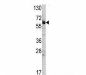 Western blot analysis of HSP60 antibody and mouse lung tissue lysate. Expected molecular weight: 55-70 kDa.