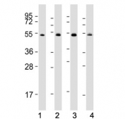 Western blot testing of human 1) Raji, 2) K562, 3) Jurkat and 4) HeLa cell lysate with HSP60 antibody. Expected molecular weight: 55-70 kDa.