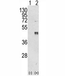 Western blot analysis of CEBPB antibody and 293 cell lysate either nontransfected (Lane 1) or transiently transfected with the CEBPB gene (2).