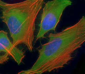 Immunofluorescent staining of permeabilized human HeLa cells with ASS1 antibody at 1:25 dilution, followed by Dylight 488-conjugated goat anti-rabbit lgG (green). Counterstains: blue (nuclear) and red (actin).