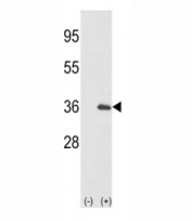 Western blot analysis of IL-1 alpha antibody and 293 cell lysate (2 ug/lane) either nontransfected (Lane 1) or transiently transfected with the IL1A gene (2). Predicted molecular weight: 31 kDa precursor and 17 kDa mature.