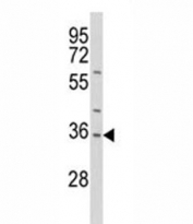 Western blot analysis of IL-1 antibody and HepG2 lysate. Predicted molecular weight of IL1A: 31 kDa precursor and 17 kDa mature.