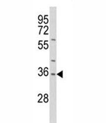 Western blot analysis of IL-1 antibody and HepG2 lysate. Predicted molecular weight of IL1A: 31 kDa precursor and 17 kDa mature.